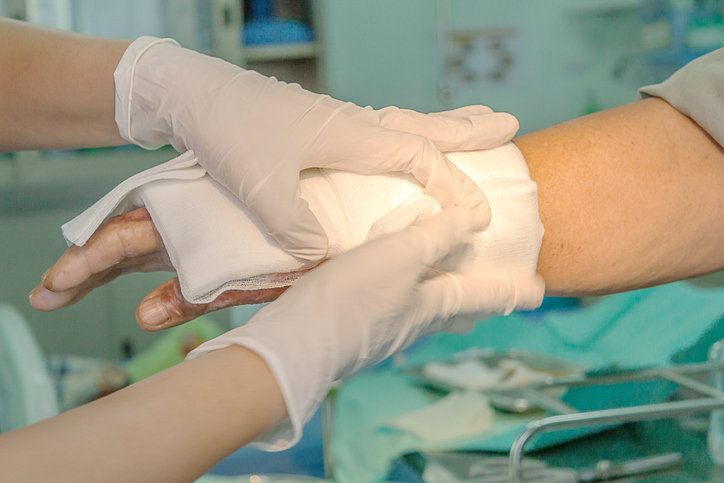 Types of Accidents That Can Lead to Serious Burn Injuries